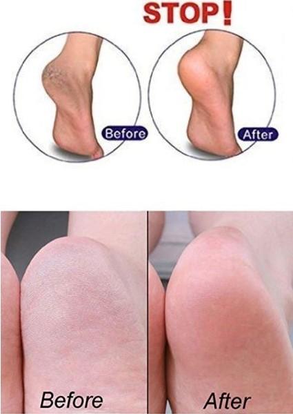 Spa Gel Moisturizing Heel Massaging Socks - Fix Dry & Cracked Feet - Affordable Compression Socks