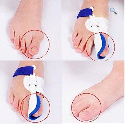 Bunion Splint Brace Straightener Corrector