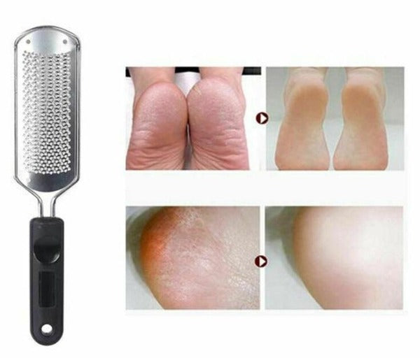 Foot File Rasp Callus Remover Black